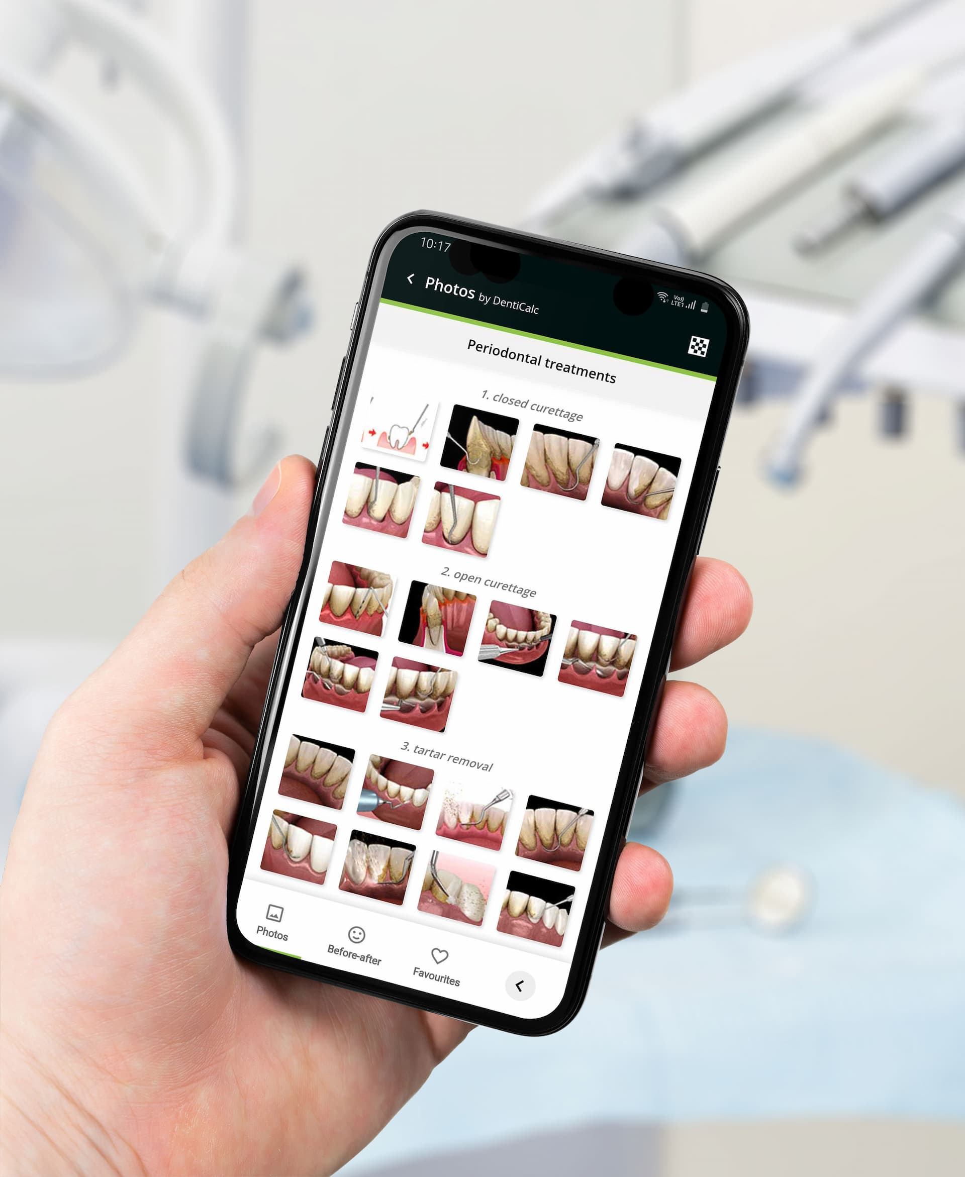 Explaining the Importance of Dental Cleanings to Patients