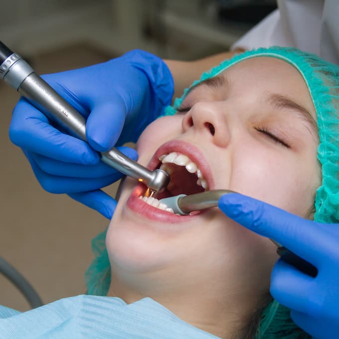 Helping Your Patients Decide Between Extractions and Root Canal or Crowns