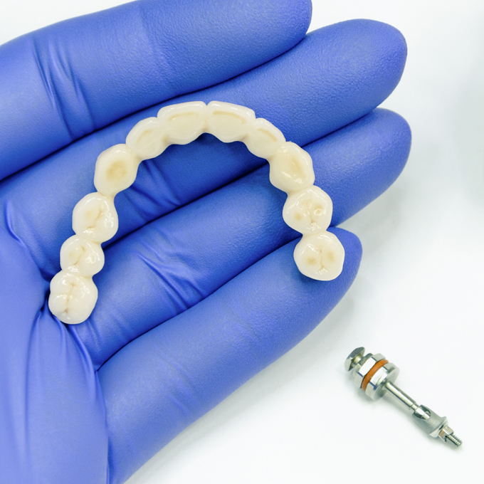 Explaining the Difference between Traditional Dentures and Implant Dentures