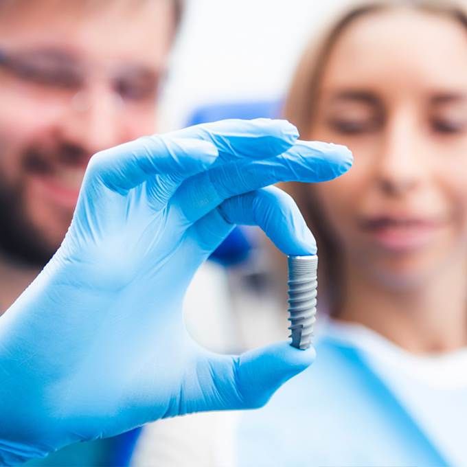 Explaining Implant Treatment