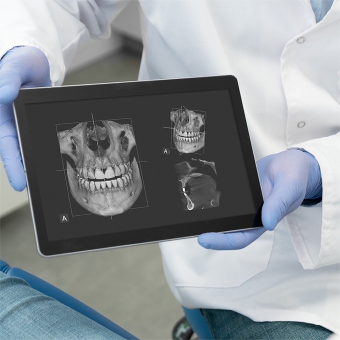 Help Patients Understand Their Treatment with Visual Aids